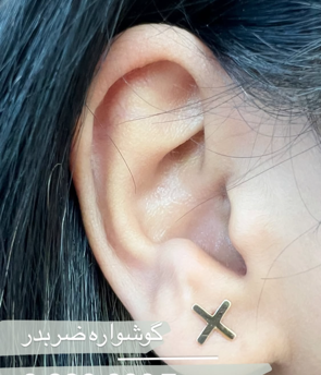 ضربدر